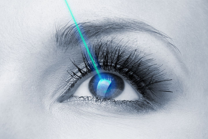 Laser Eye Surgery / LASIK
