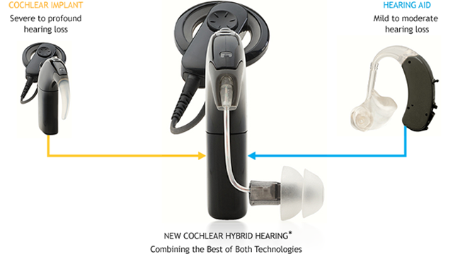 Cheap But Good Hearing Aids