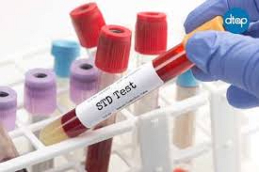 Std Test Malaysia