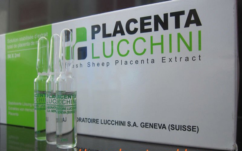 Lucchini sheep Placenta