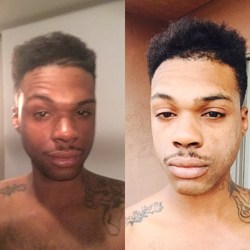 Skin Lightening Cream +27737164392 Bleaching Injection In CANADA JOHANNESBURG TEMBISA GERMANY CAPETOWN. DR ZIBA