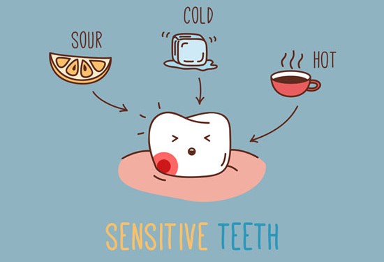 Dental Veneers