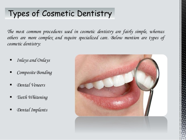 Dental Veneers