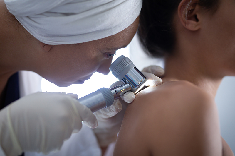 Are You Looking for Acne Dermatologist in Kuala Lumpur?