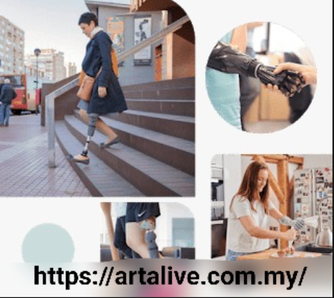 Specialised Prosthetics Services In Malaysia
